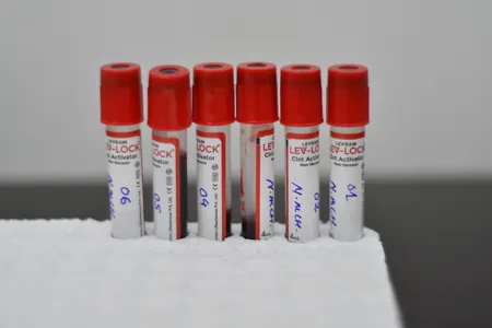 A French woman from Guadeloupe is the only known person in the world with the &quot;Gwada negative&quot; blood type.

