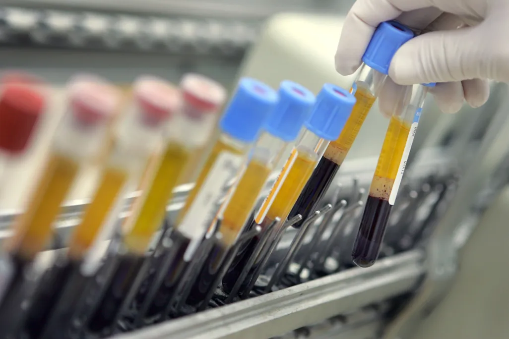 A row of blood samples in vials