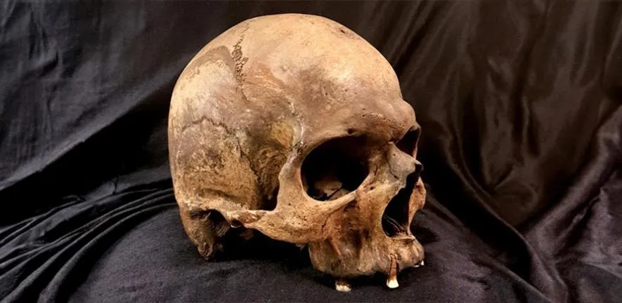 a skull on cloth