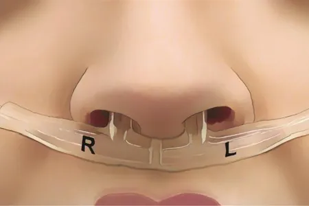 Researchers developed a wearable device to monitor participants&#39; breathing.